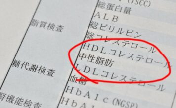 中性脂肪とコレステロールの違い｜役割や数値改善の対策も解説